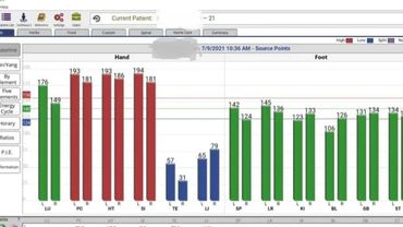 Acupuncture Acugraph Chinese medicine