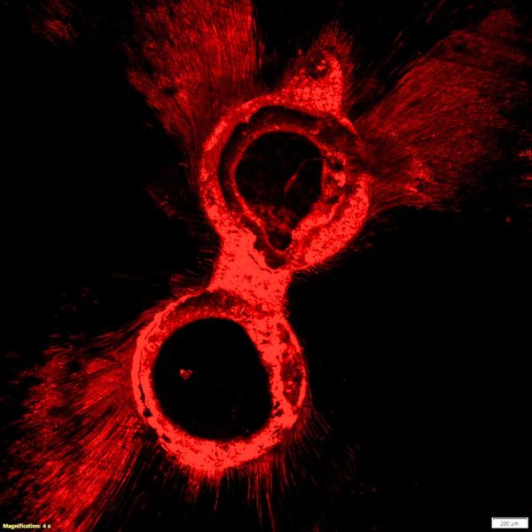 Dental Adhesive bonding dye penetration test using Confocal Microscope (CLSM)