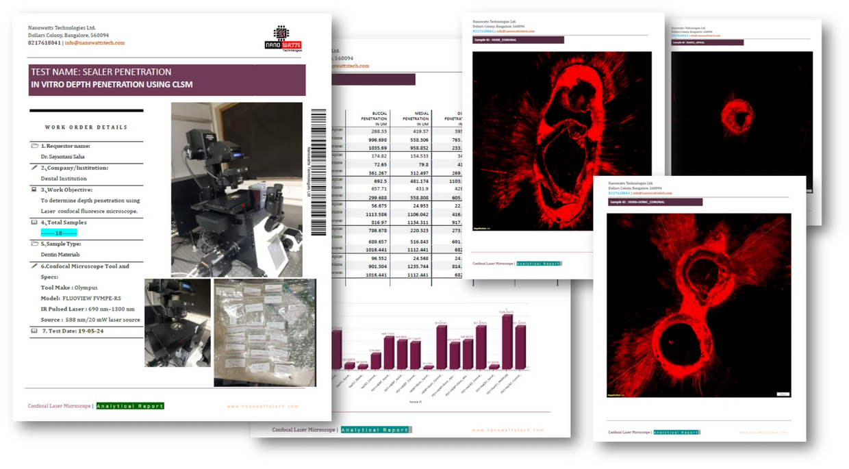 Confocal Microscopy  CLSM Lab Report on Microleakage Dye  Penetration In Vitro Study