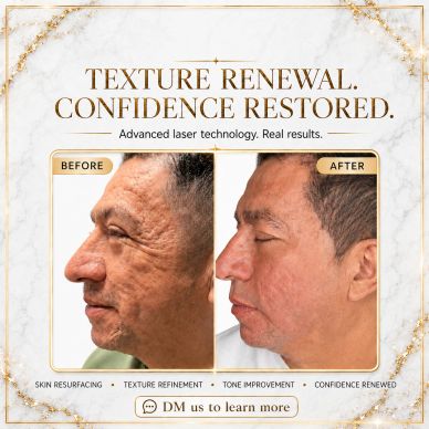 Before and after images showing skin improvement with laser treatment.