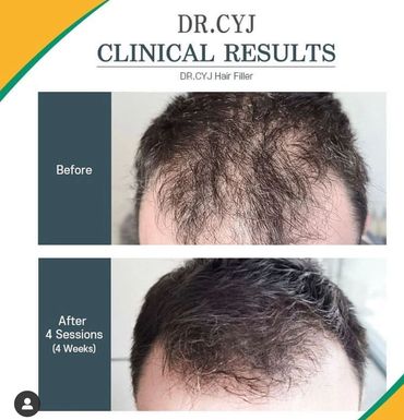 Comparación Dr. CYJ 2