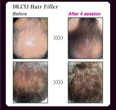 Comparación Dr. CYJ 3