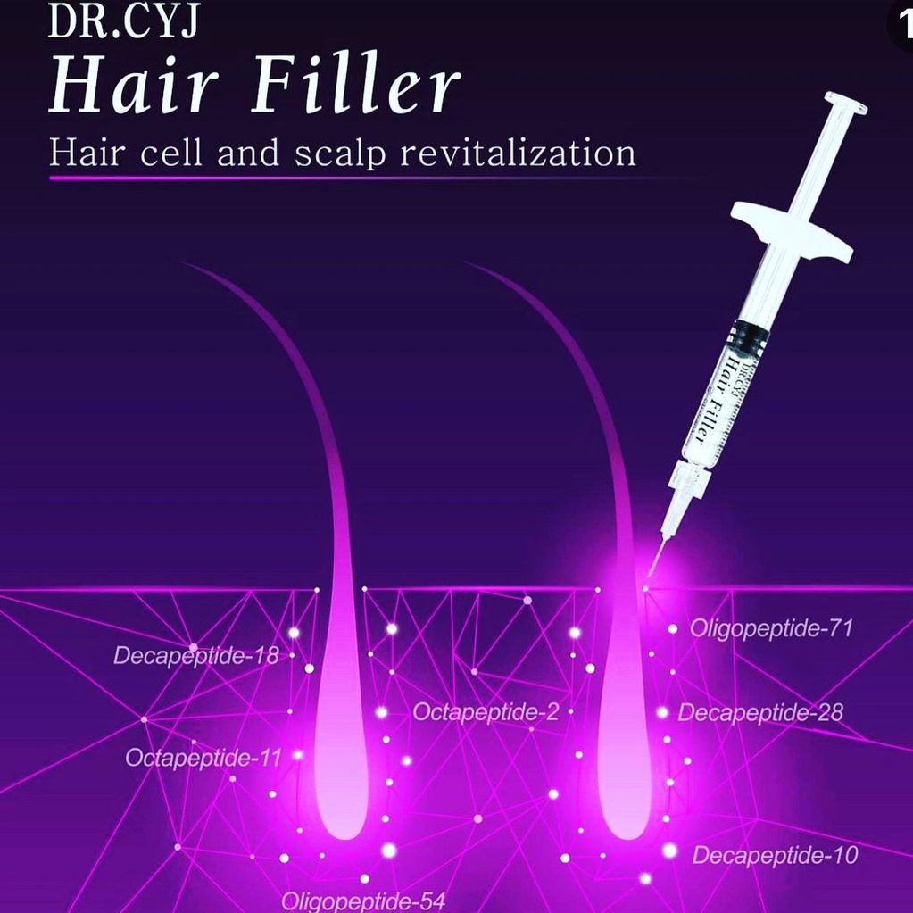 Diagrama Reacción Inyección
