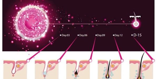 Dr. Cyj Hair Filler Diagrama