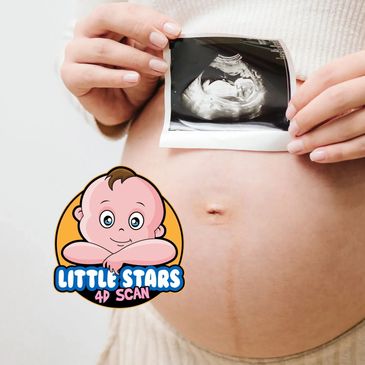 Pregnancy care 4 Scan package
little stars 4d scan
big discounts scan packages
pregnancy scans