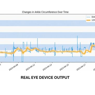 Graph showing ankle circumference changes over time with distance and 12-hour moving average.