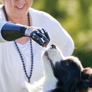 TASKA Prosthetic hand