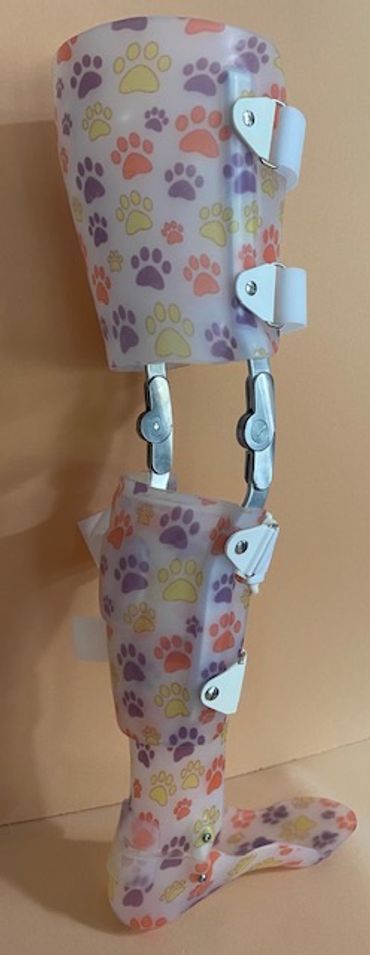 Custom KAFO Lower extremity bracing