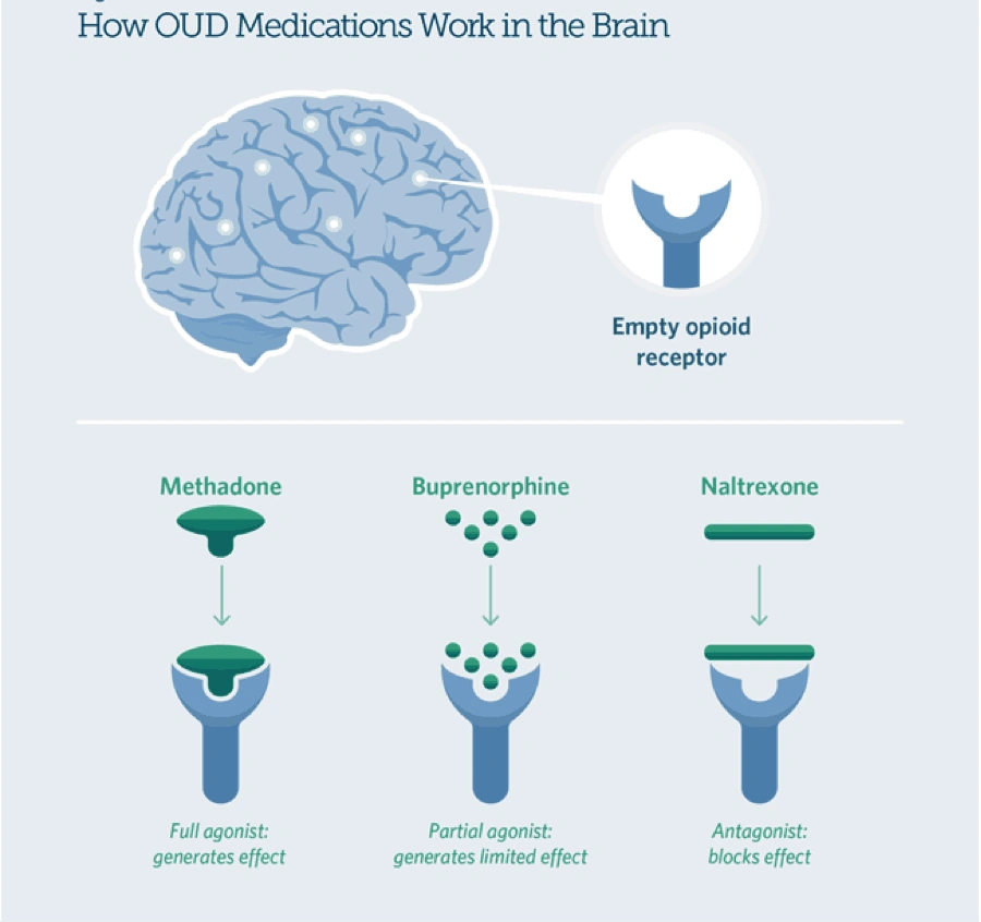 How buprenorphine (Suboxone), naltrexone, methadone and oud medications work in the brain.