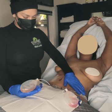 Lymphatic Massage in Long beach, pasadena, Compton,