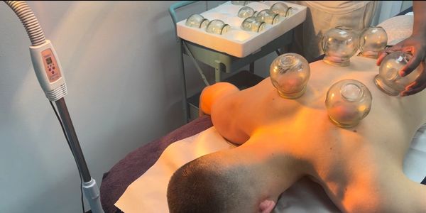 A massage therapist offering a cup massage