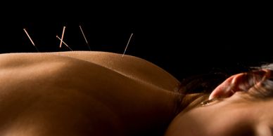 Acupuncture stress fatigue genevieve Paradis acupuncture japonaise