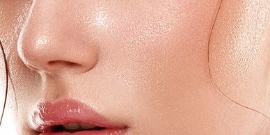 Picture showing Oily Skin Type