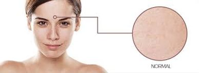 Picture showing Normal Skin Type