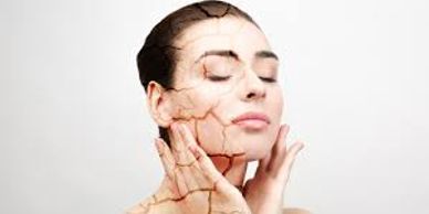 Picture showing Dry Skin Type