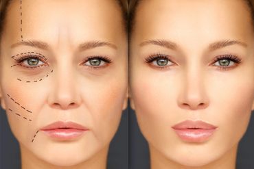 injectables,fillers,Botox,Restylane,
neurotoxins,Botox, Dysport,Treatments,Experience, Expertise