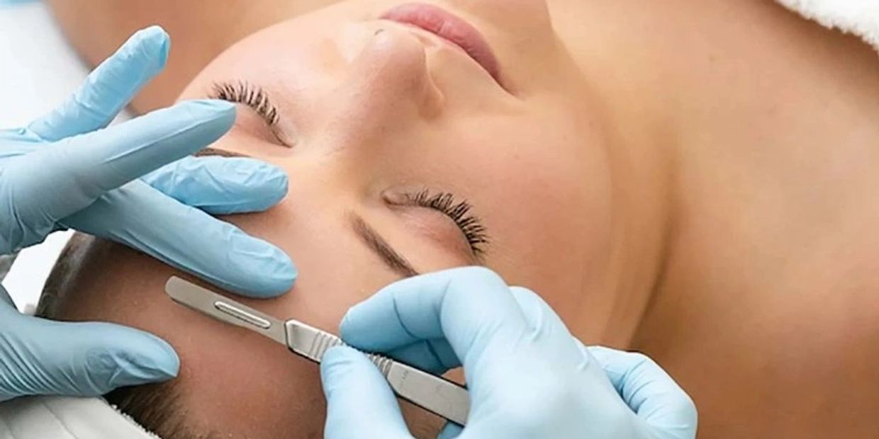 This woman is experiencing dermaplaning at About Skin Spa in Ocala, FL. 34470