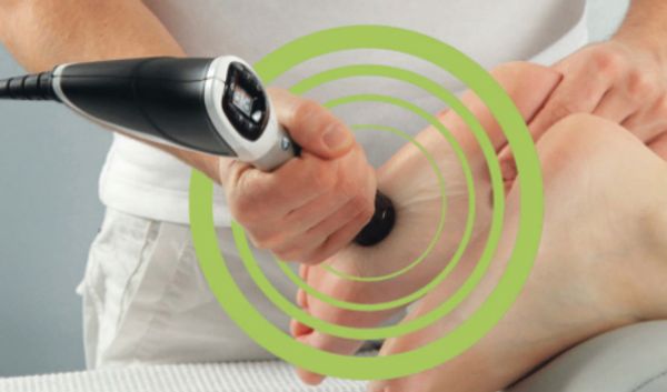 Extracorporeal Shockwave Therapy