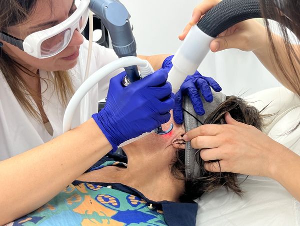 Rejuvenecimiento facial Láser CO2 fraccionado