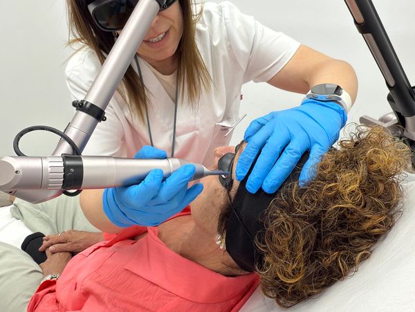 Eliminación tatuaje con Láser Picosegundo en Castelldefels