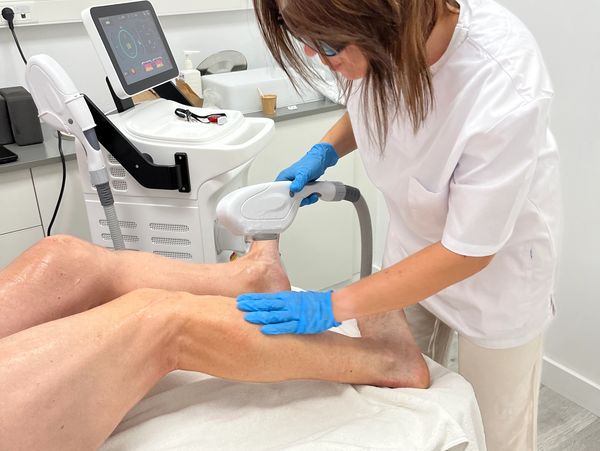 Eliminación vello corporal con Láser Diodo en Castelldefels