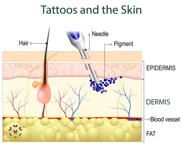 Diagram of tattoo needle injecting pigment into skin layers.