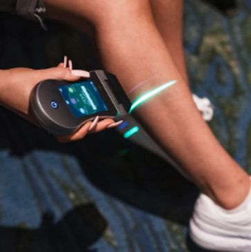 Low-level laser therapy on calf