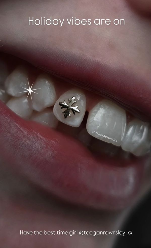 Close-up of teeth with a festive snowflake decoration.