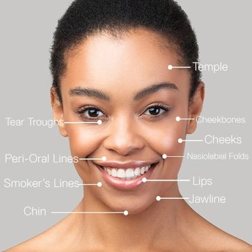 Dermal Filler