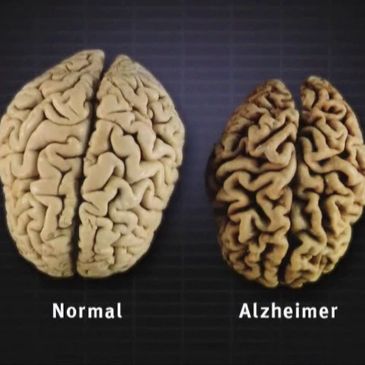Gut Brain Axis Blog