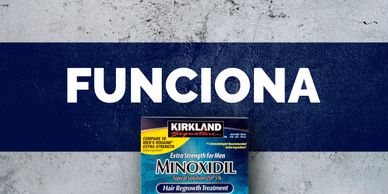 Minoxidil Kirkland 5% Solución Tópica y Espuma, Si Funciona