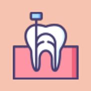 Root Canal Treatment in Glitz Dental Clinic in Vadodara