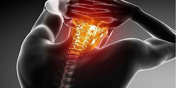 3D illustration showing neck pain with highlighted cervical spine.