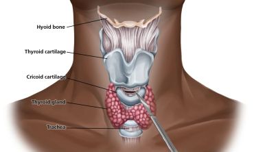 Anatomical illustration of the neck showing thyroid gland and related structures.