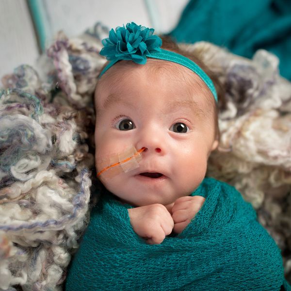 premature baby, premmie baby, paediatric physio, developmental delay