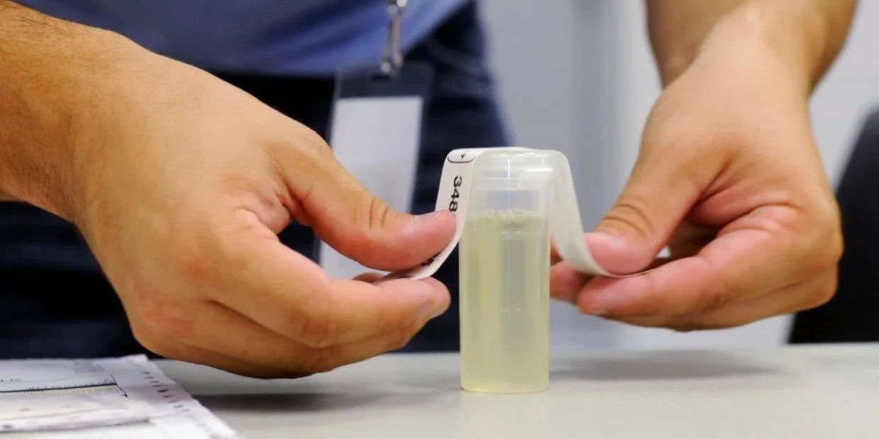 Person attaching a label to a small container with liquid.