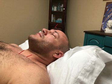 IBJJF wold champ Anthony Falotica getting acupuncture