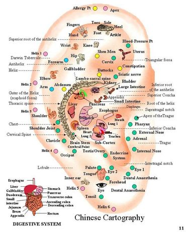 Auricular therapy diagram.