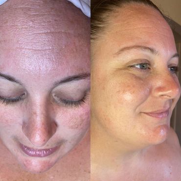 Tighten and firm skin care
