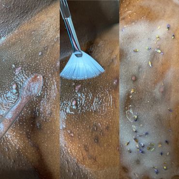 Brazilian waxing and skin care for intimate areas