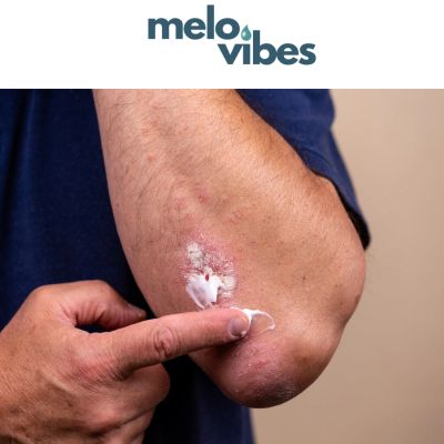 Applying cream to an irritated elbow.