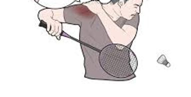 Man holding his shoulder in pain while playing tennis, indicating shoulder impingement.