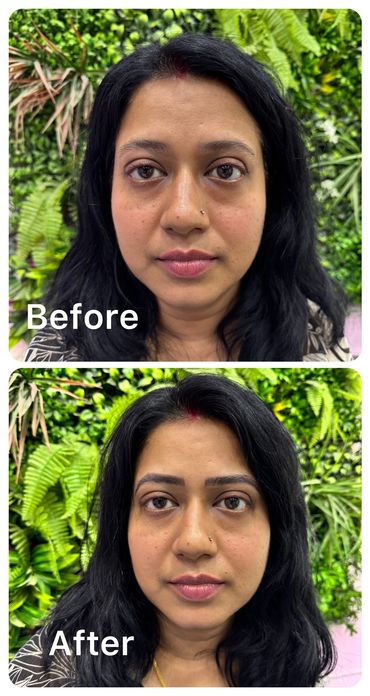 Before and after Microblading Treatment