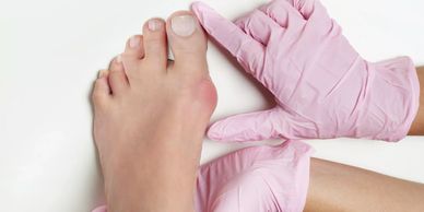 A podiatrist is examining a foot deformity.