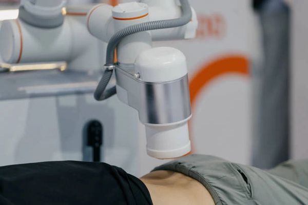 Robotic laser device on torso.