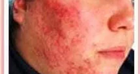 Advanced Dermatology Specialists