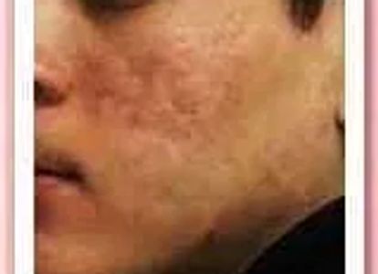 Advanced Dermatology Specialists