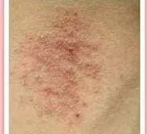 Advanced Dermatology Specialists