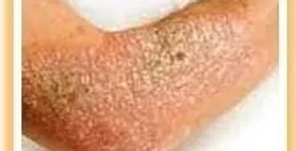 Advanced Dermatology Specialists