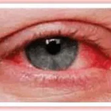 Advanced Dermatology Specialists